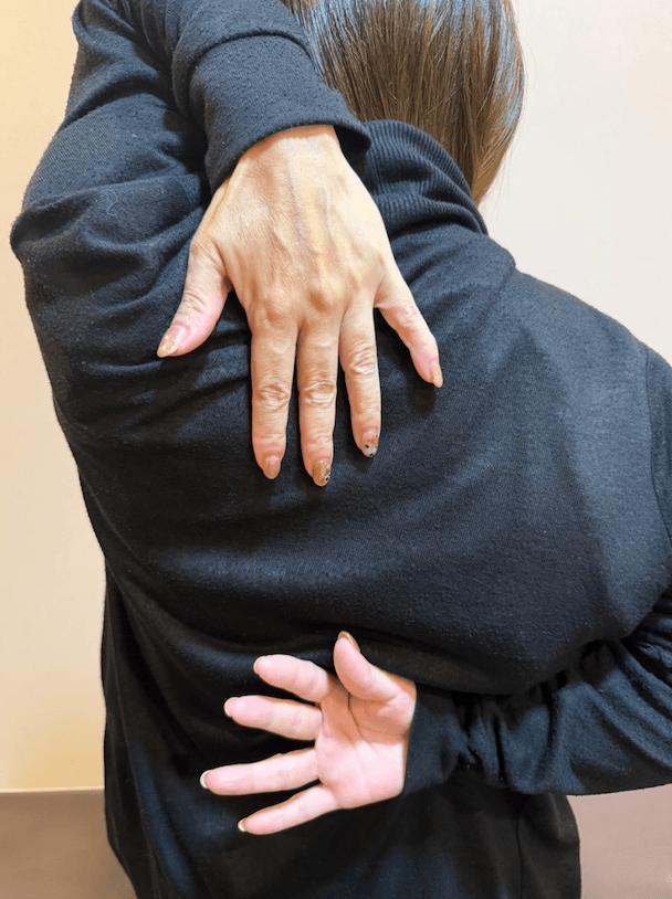 施術後の状態（After 3）