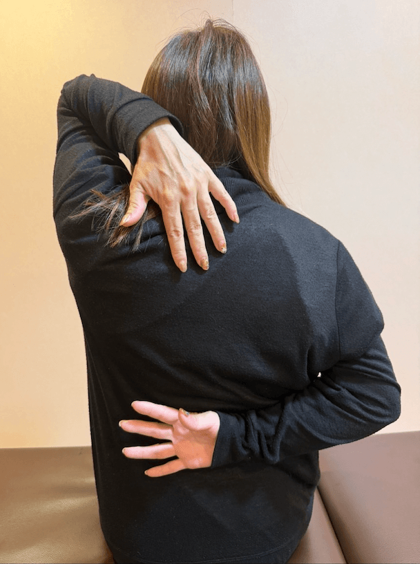 施術前の状態（Before 3）